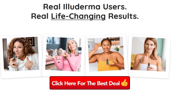 illuderma cream ireland reviews